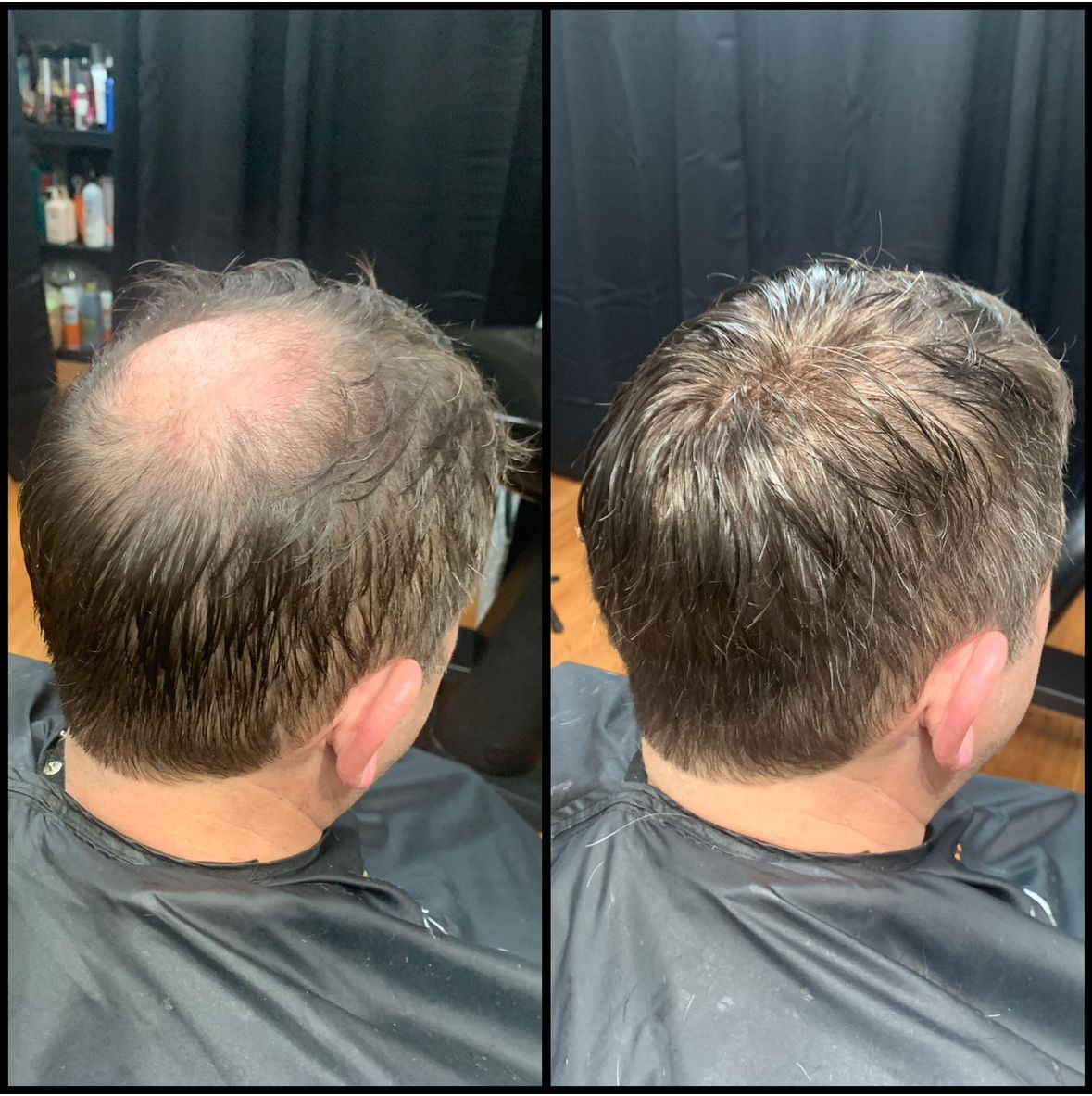 Side-by-side view of thinning hair on the crown before and after a haircut, against a dark background