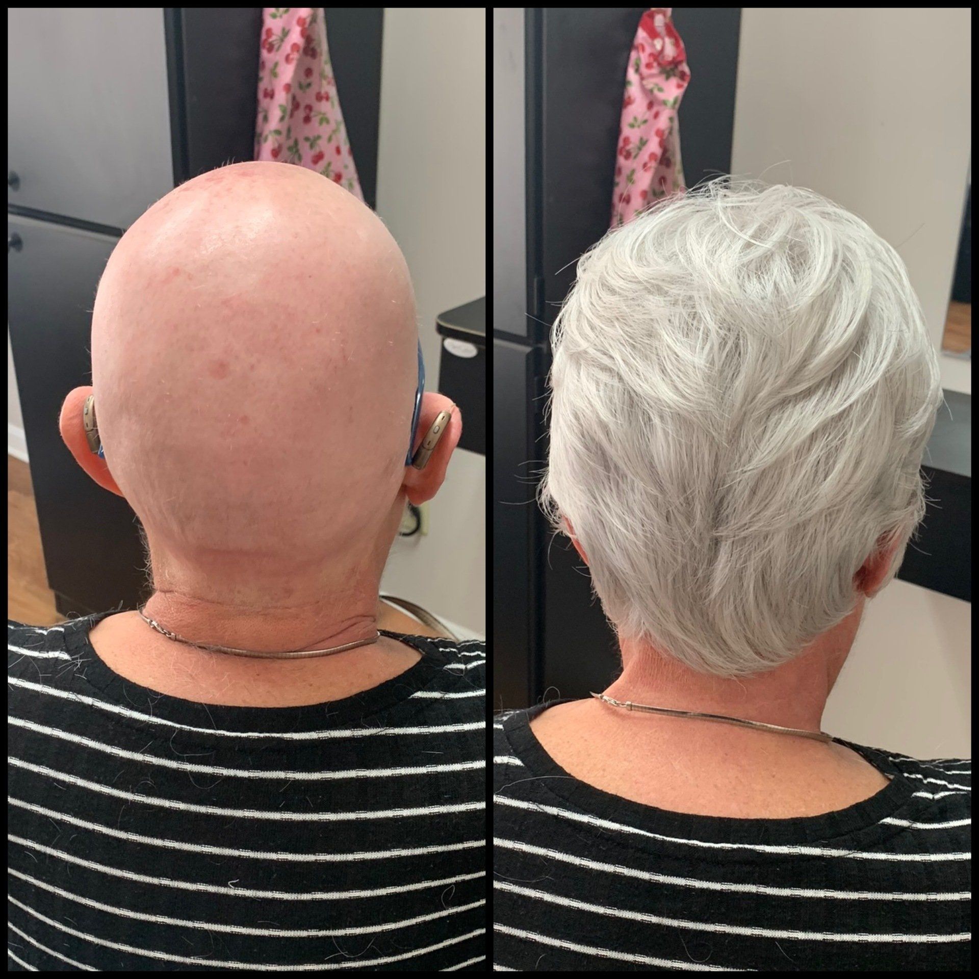 Back view comparison of a bald head and the same head with short white hair, side by side.