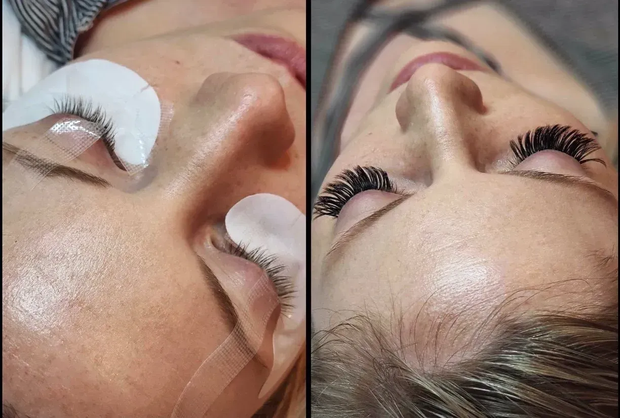 Close-up of eyelash extension application on a person’s closed eyes, showing before and after results.