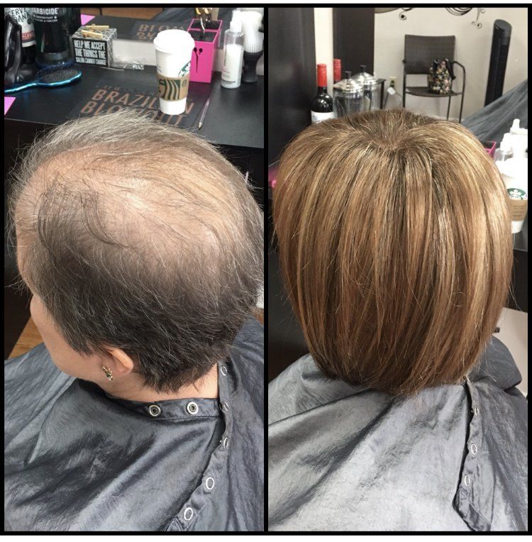 Before-and-after salon photo of a thinning scalp transformed with a fuller layered bob haircut