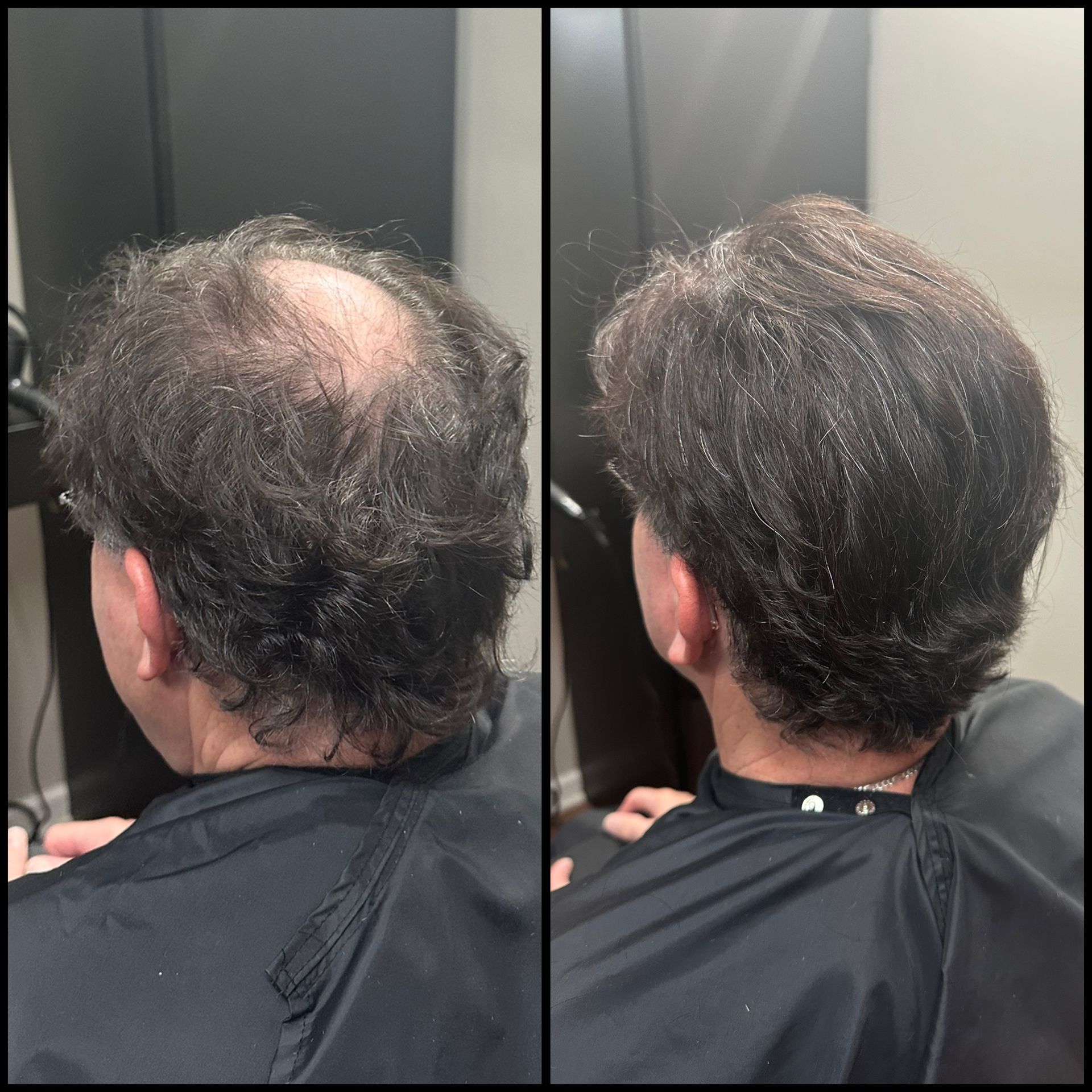 Side-by-side rear view of thinning hair before and after a haircut, with fuller-looking hair on the right.