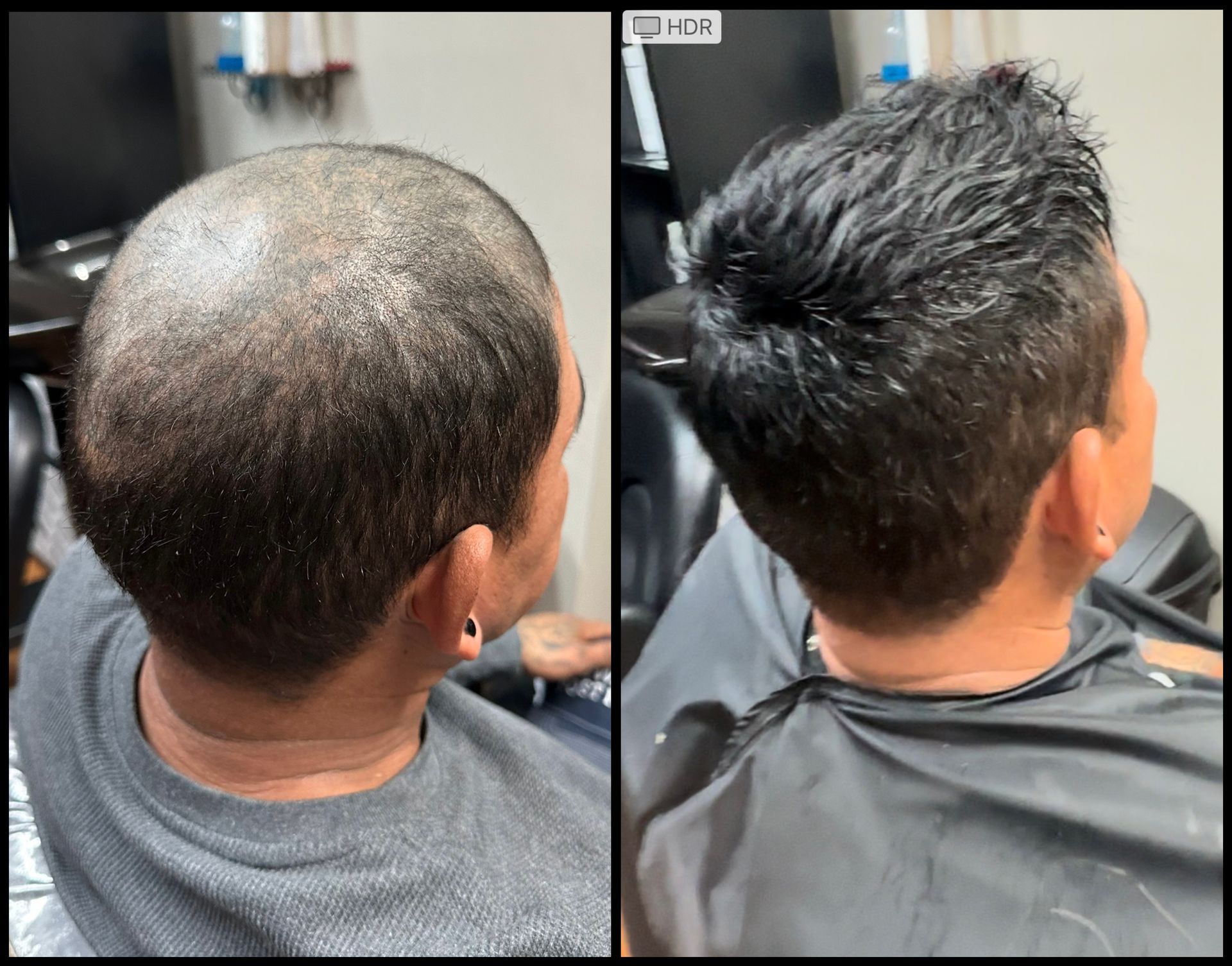 Side-by-side rear views of a man's head showing a bald scalp before and after a haircut