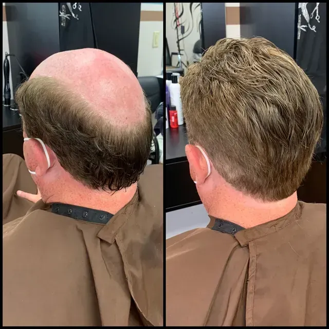 Split-screen of a barber’s hair design transform: bald crown to blended short hairstyle
