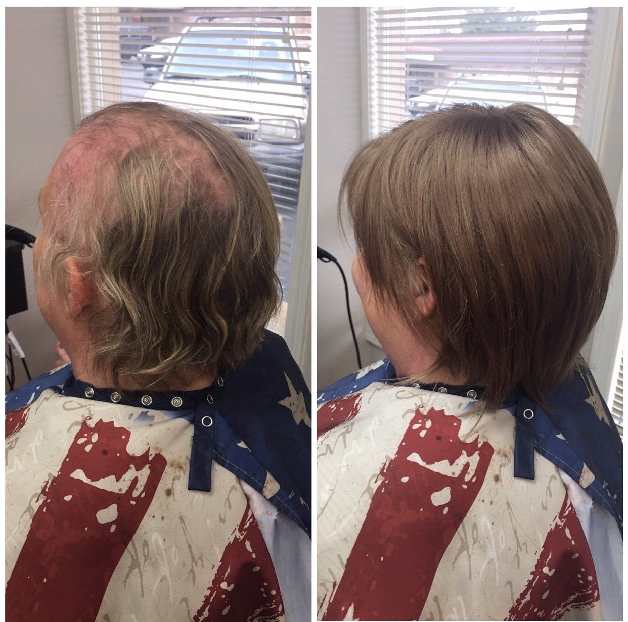 Before-and-after salon photo of a short brown haircut, showing the back and side views with thinning hair improved.