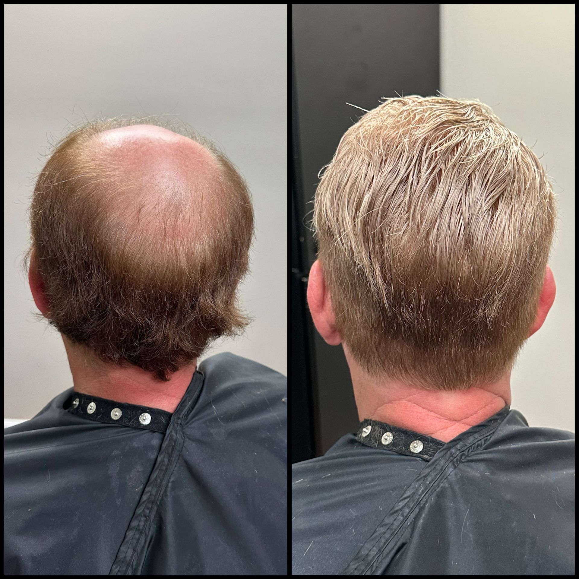 Back view before-and-after haircut: balding crown on left, fuller short blond hair on right