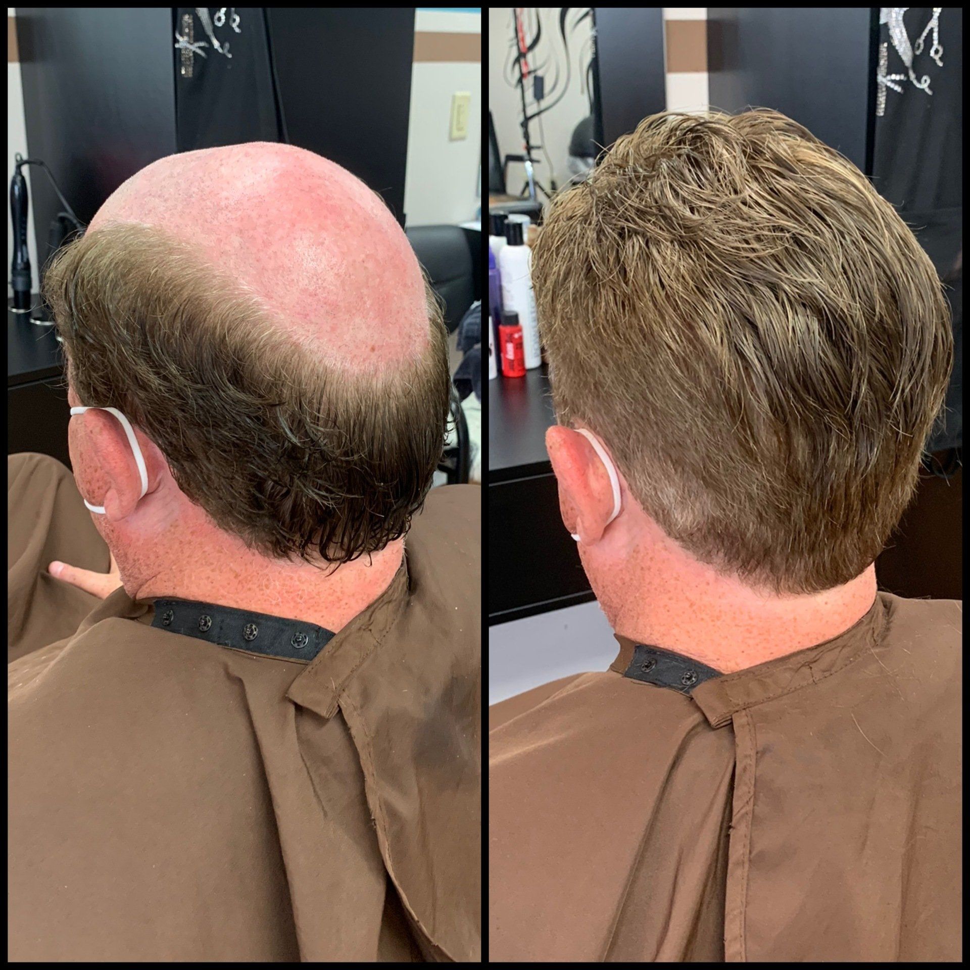 Before-and-after salon view of a balding man’s hair restoration style from back of head, shown side by side.