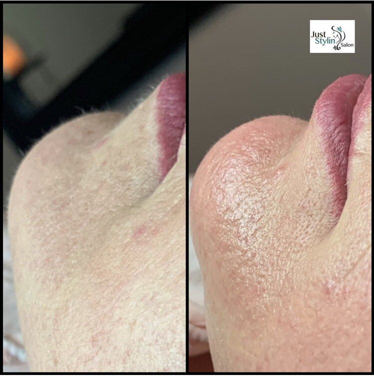 Side-by-side close-up of a dog’s snout before and after moisturizing, showing dry and shiny skin.