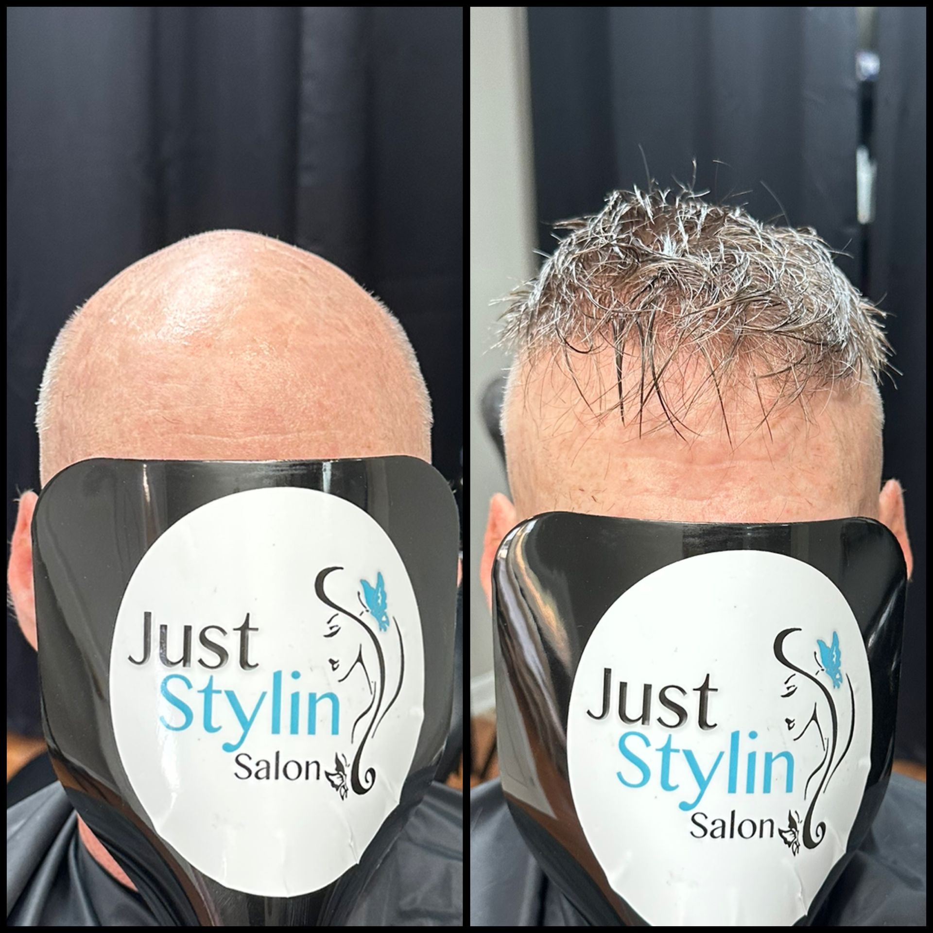 Before-and-after hair restoration: bald scalp compared with short, wet hair growth at a salon.