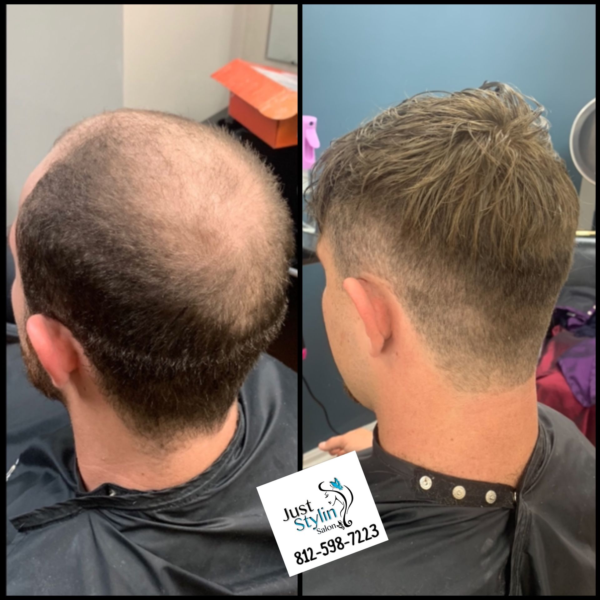 Back of head before-and-after haircut: thinning top on left, short blended fade on right.
