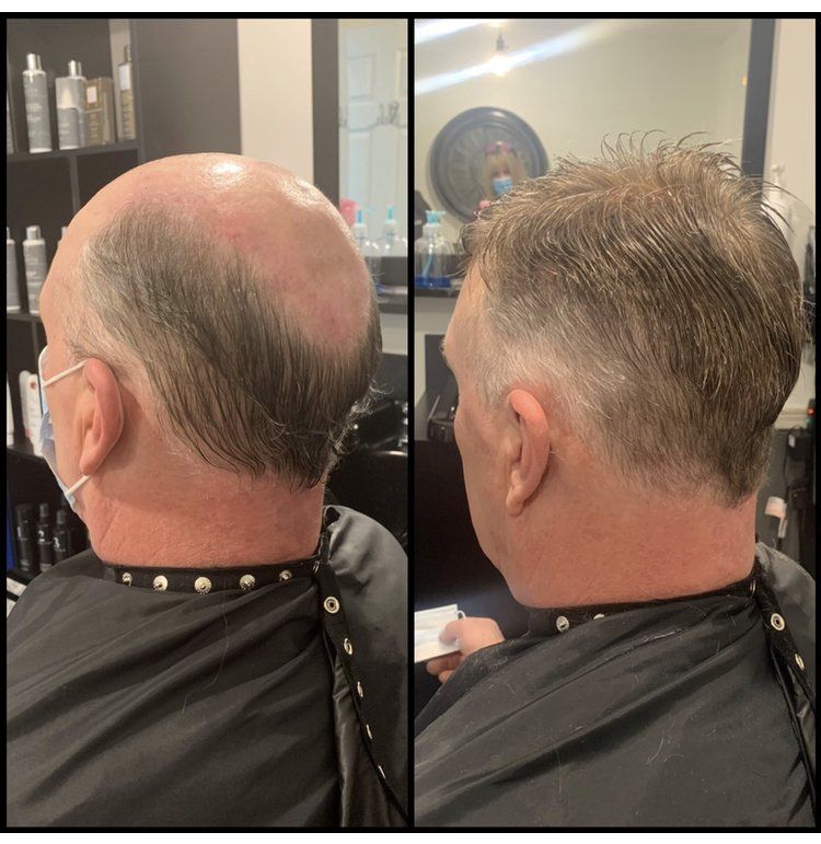 Side-by-side salon photos showing a balding scalp before and after a shorter haircut from the back and side